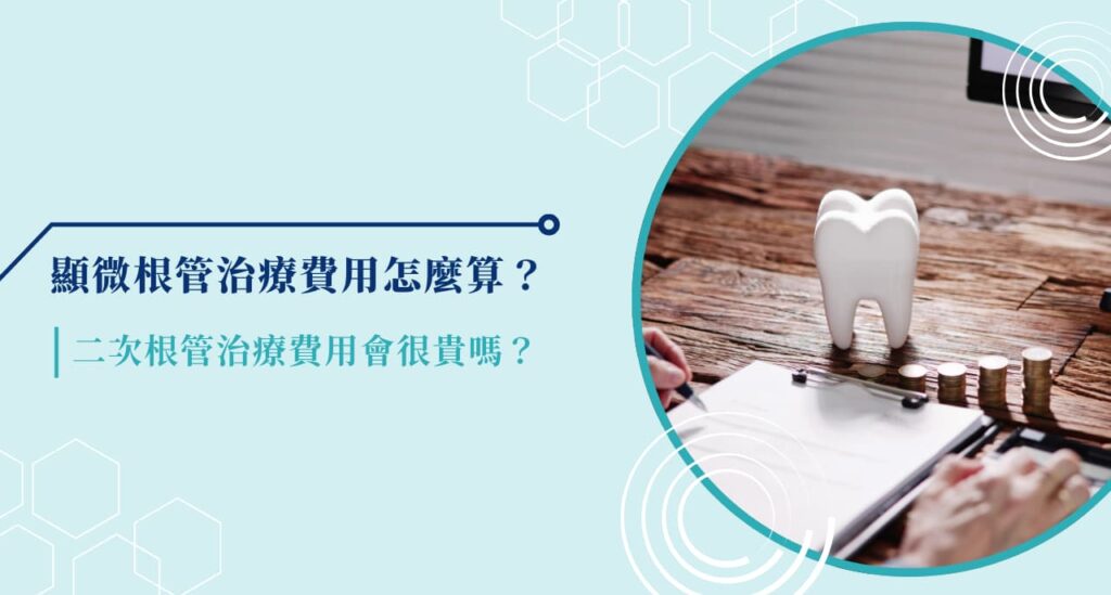 顯微根管治療費用怎麼算?二次根管治療費用會很貴嗎?
