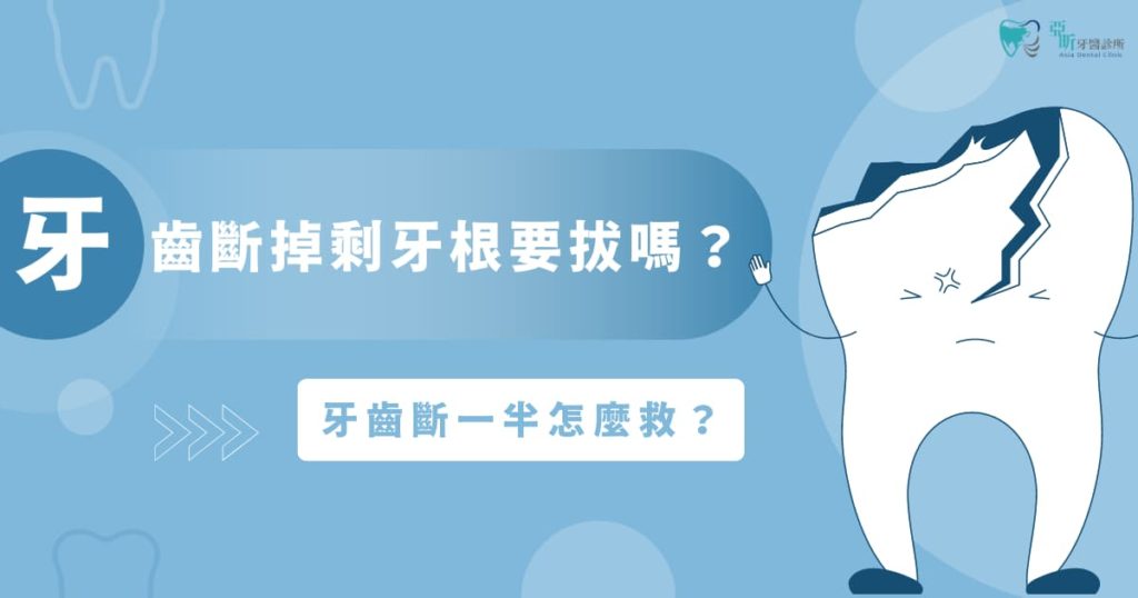 牙齒斷掉剩牙根要拔嗎?牙齒斷一半怎麼救?本篇一次瞭解!