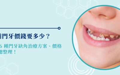 補門牙價錢要多少? 6 種門牙缺角治療方案、價格總整理!