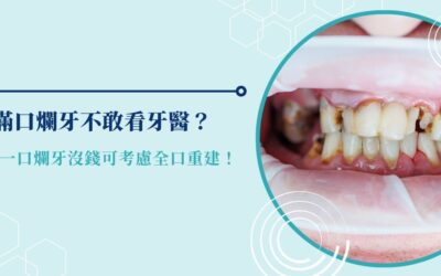滿口爛牙不敢看牙醫?一口爛牙沒錢可考慮全口重建!