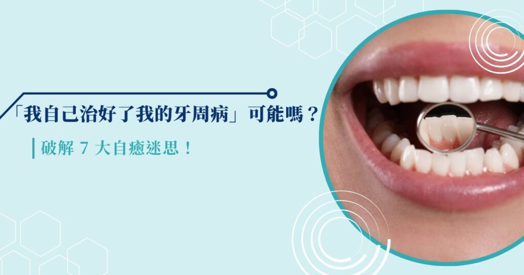 「我自己治好了我的牙周病」可能嗎?破解 7 大自癒迷思!