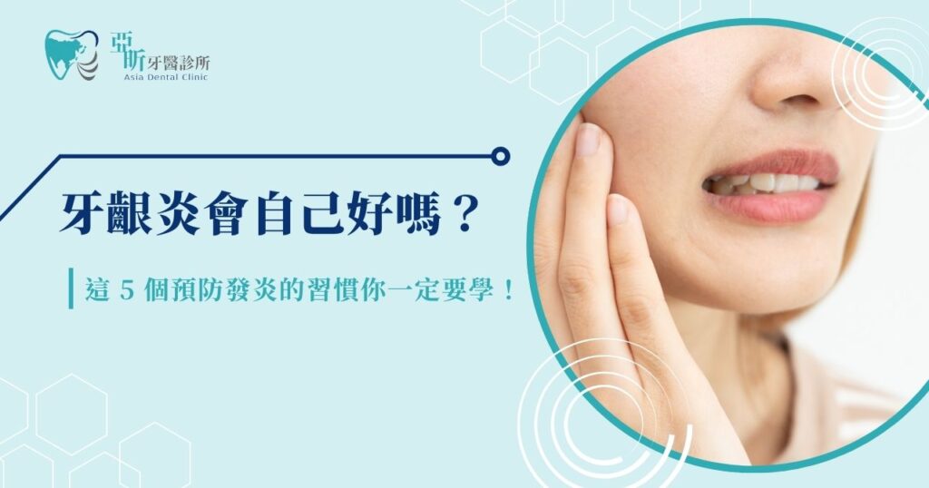 牙齦炎會自己好嗎?這 5 個預防發炎的習慣你一定要學!
