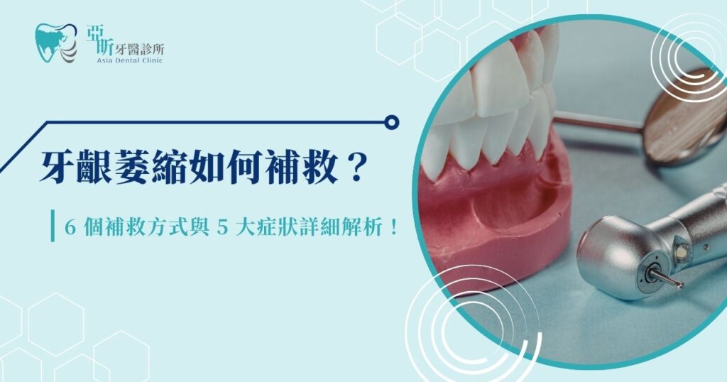 牙齦萎縮如何補救?6 個補救方式與 5 大症狀詳細解析!