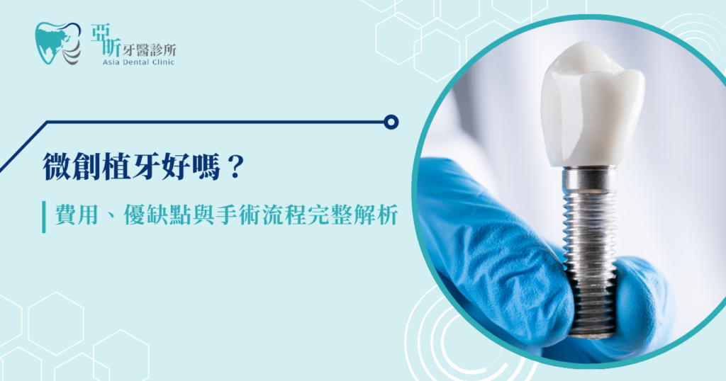 微創植牙好嗎?費用、優缺點與手術流程完整解析