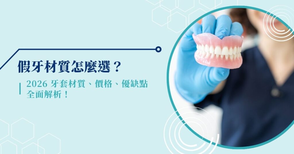 假牙材質怎麼選?2026 牙套材質、價格、優缺點全面解析!