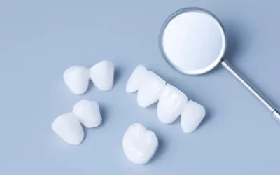 3D齒雕是什麼？30秒搞懂3D齒雕優缺點、治療流程
