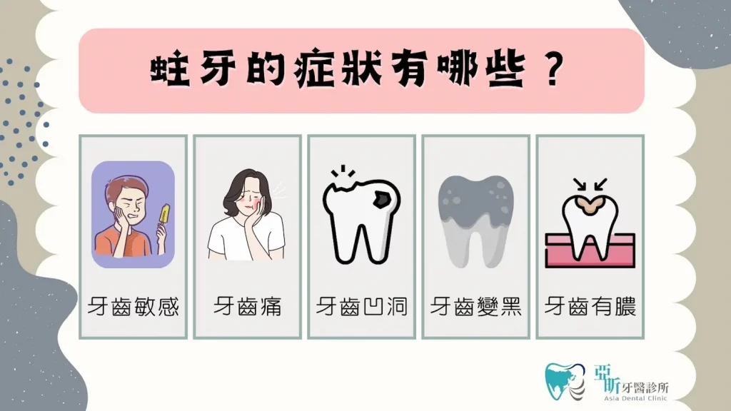 蛀牙的症狀有哪些？1.牙齒敏感 2.牙齒痛 3.牙齒凹洞 4.牙齒變黑 5.牙齒有膿