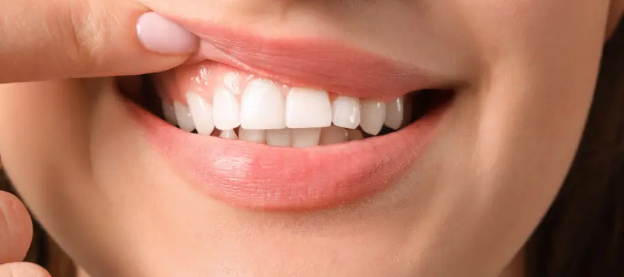 牙齦天然再生方法