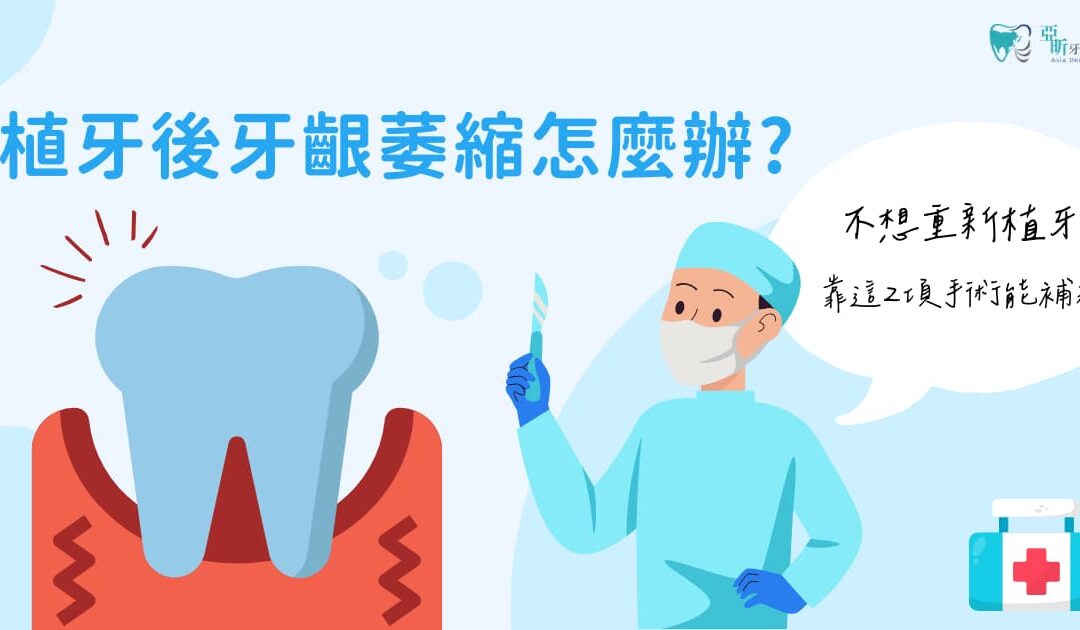 植牙後牙齦萎縮怎麼辦？靠這 2 項手術補救！