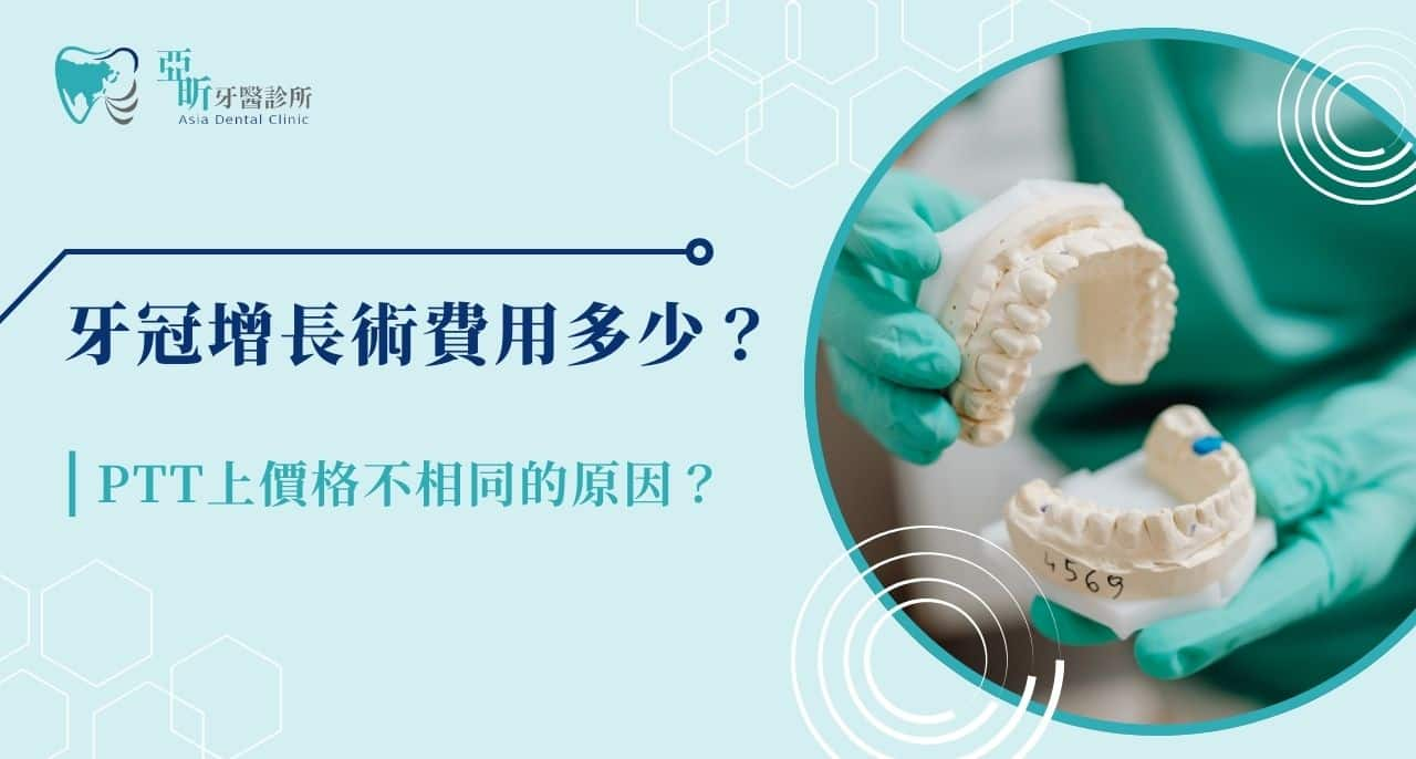 牙冠增長術費用多少？PTT上價格不相同的原因是？