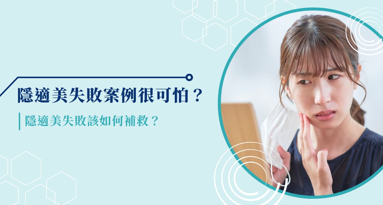 隱適美失敗案例很可怕？隱適美失敗該如何補救？