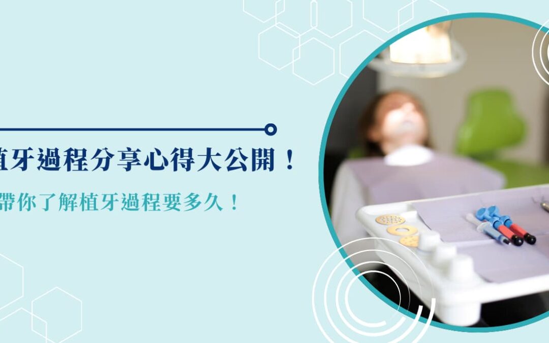 植牙過程分享心得大公開！帶你了解植牙過程要多久！