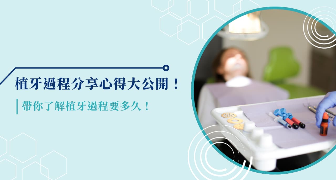 植牙過程分享心得大公開！帶你了解植牙過程要多久！