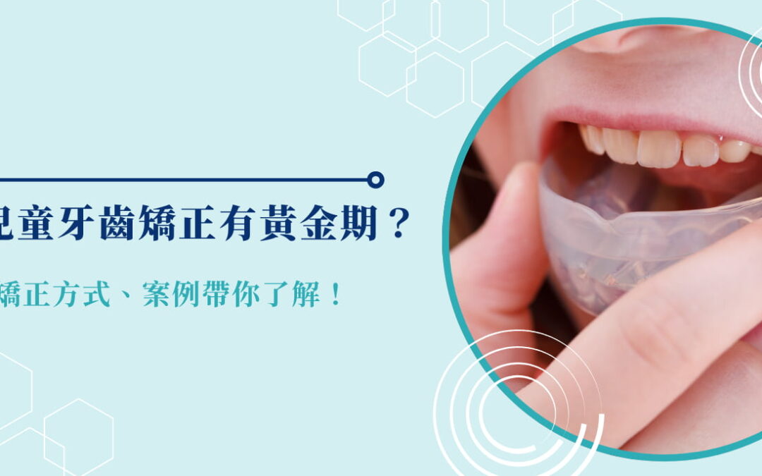 兒童牙齒矯正有黃金期？矯正方式、案例帶你了解！